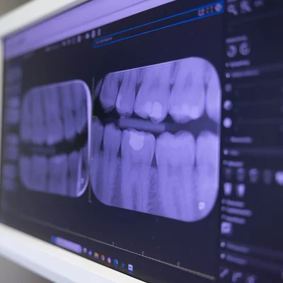 voll-digitalisierte-zahnarztpraxis-kieferorthopaedie-in-horw-1